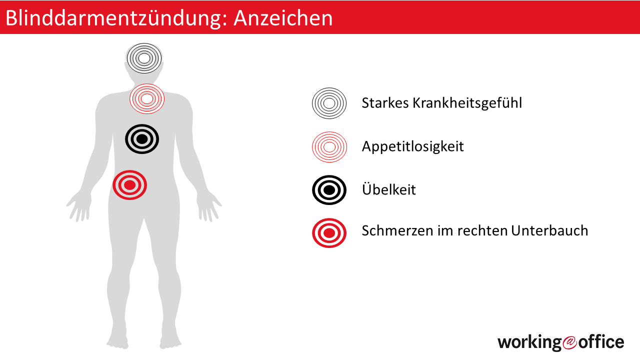 Blinddarm entzündet Anzeichen